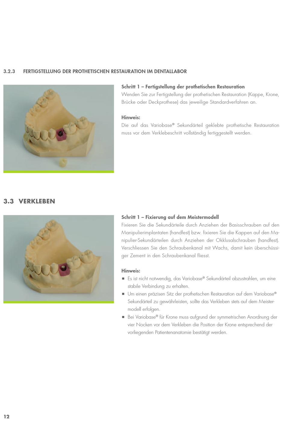 Verkleben - Straumann Variobase Anleitung [Seite 14] | ManualsLib