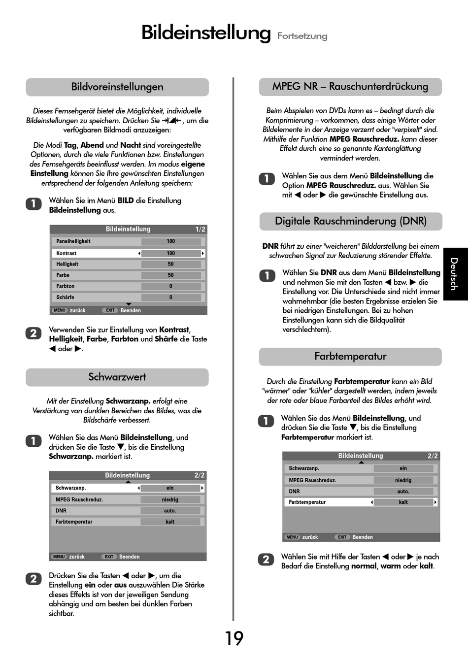 Mpeg Nr Rauschunterdrückung; Digitale Rauschminderung (Dnr