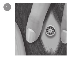 Haare vom Abutment entfernen.
