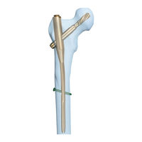 Johnson & Johnson DePuy Synthes TFN Operationstechnik