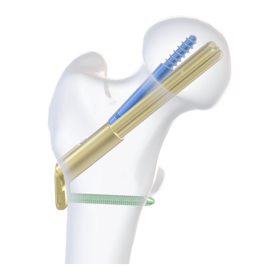 Depuy Synthes Femoral Neck System Operationstechnik